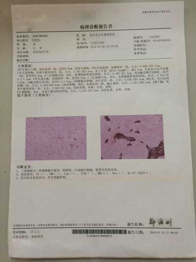 检查,当地医生经各项检查初步诊断马女士患了左侧外耳道鳞状细胞癌,并